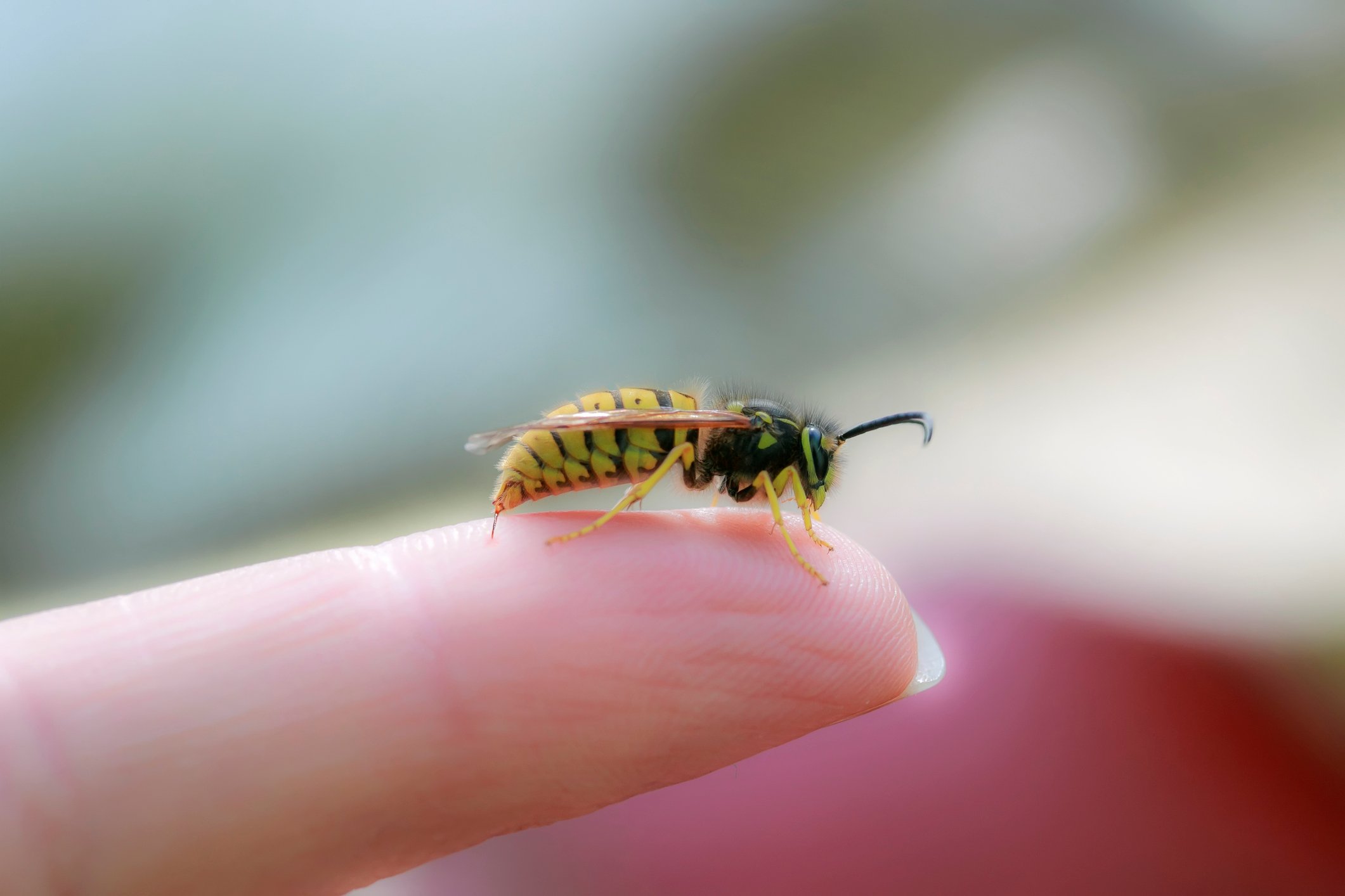 A wasp stings a human finger.